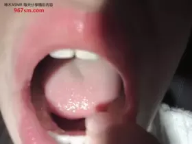 菜菜cyl不好吃_口腔检查 (图1)