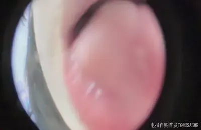布鲁比呐呐11内窥镜视角 (图1)